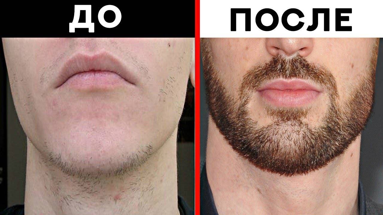 Как отрастить бороду - этапы роста, стиль и уход