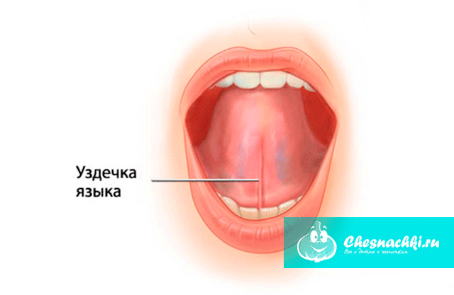 Пластика уздечки языка и губ