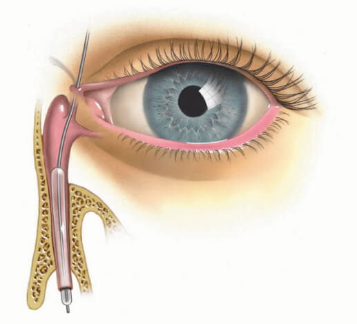 Приморский центр лазерной коррекции зрения и офтальмохирургии