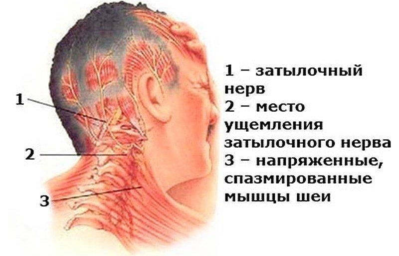 Боль в шее при наклоне и повороте головы: причины и лечение | ким