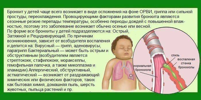 Боль в горле у детей: причины, чем лечить боль в горле у ребенка без температуры