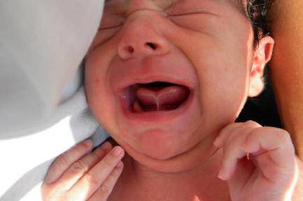 Глоссит языка у детей — лечение в клинике дентал фэнтези, виды заболевания с фото, этиология