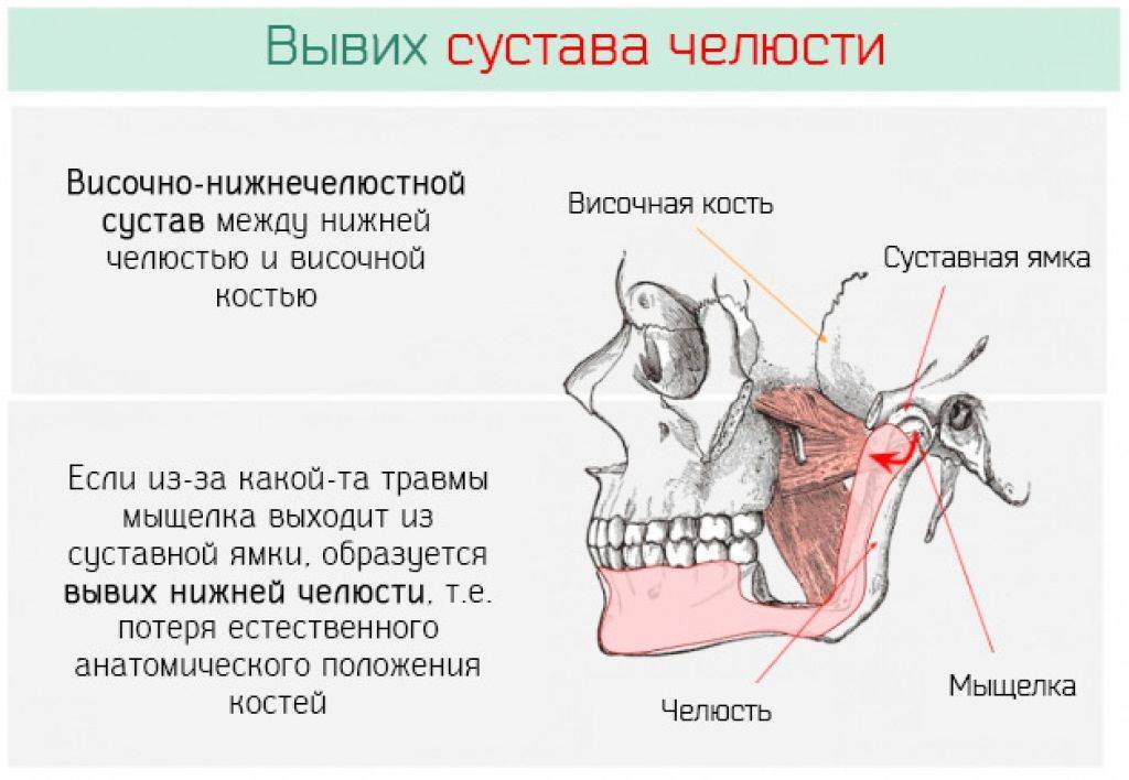 От чего может болеть челюсть. Почему болит челюсть снизу. Болит сбоку нижней челюсти. Мышцы и связки височно-нижнечелюстного сустава. ВНЧС костные структуры.