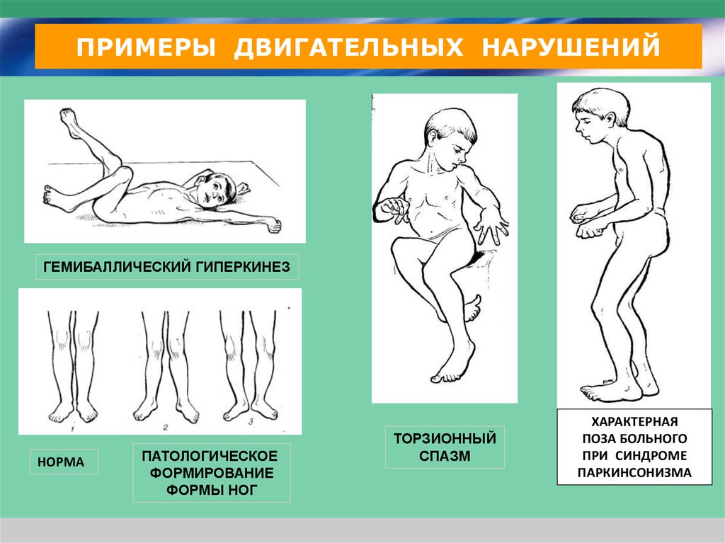 Почему маленький ребенок кряхтит и пищит