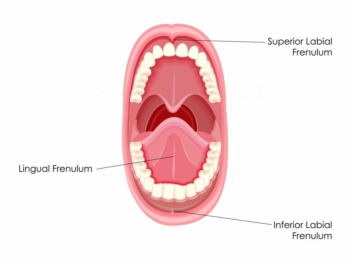 Аномалии развития слизистой оболочки полости рта
