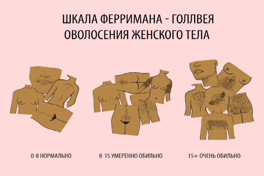 Мужской Тип Оволосения Фото