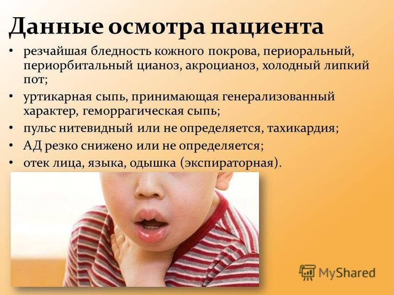 Кашель у ребенка диагноз. Аллергический кашель у ребенка симптомы. Аллергический кашель детский. Лающий аллергический кашель у ребенка. Аллергия кашель у ребенка симптомы.