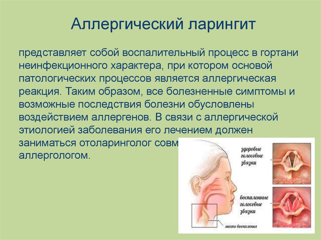 Тревожные нотки в голосе ребенка: о чем говорит охриплость…
