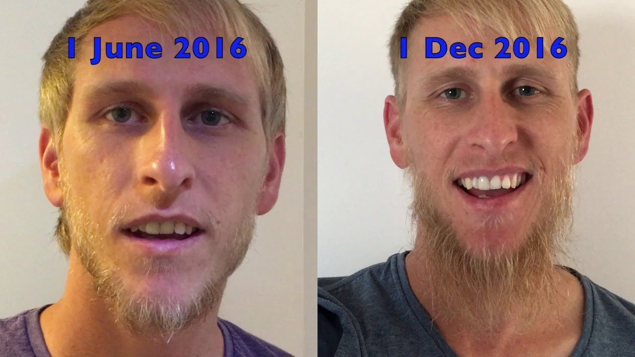 Как отрастить красивую бороду в 14-17 лет